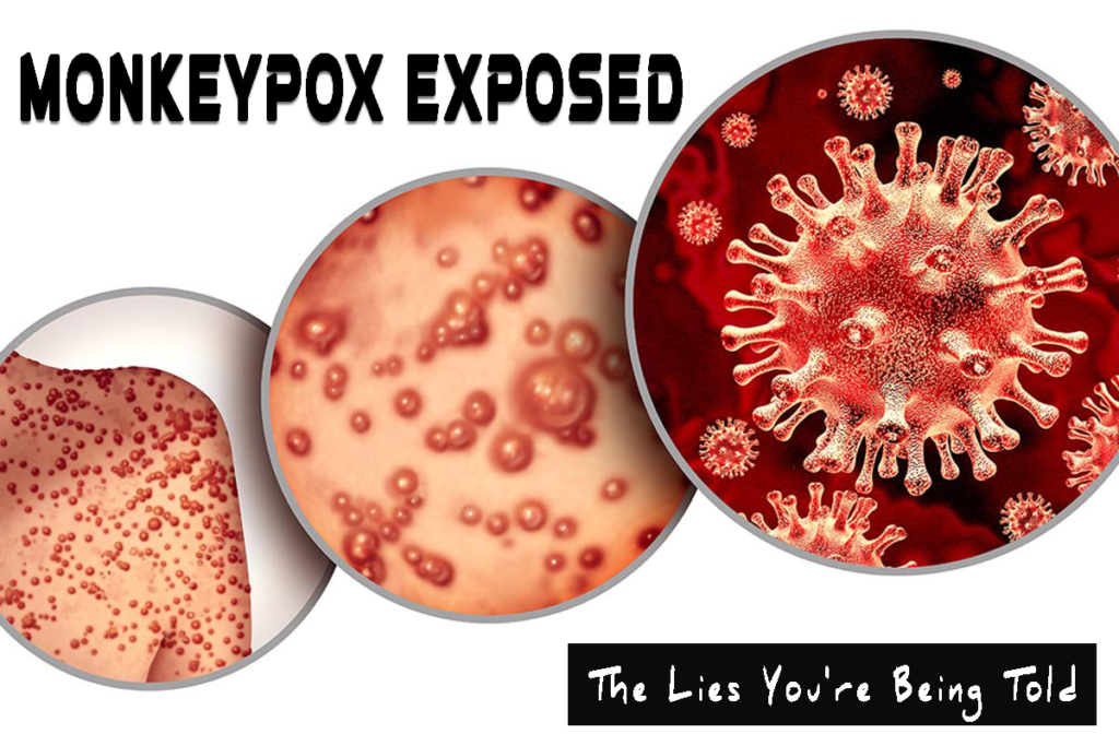 Monkeypox Exposed – The Lies You’re Being Told